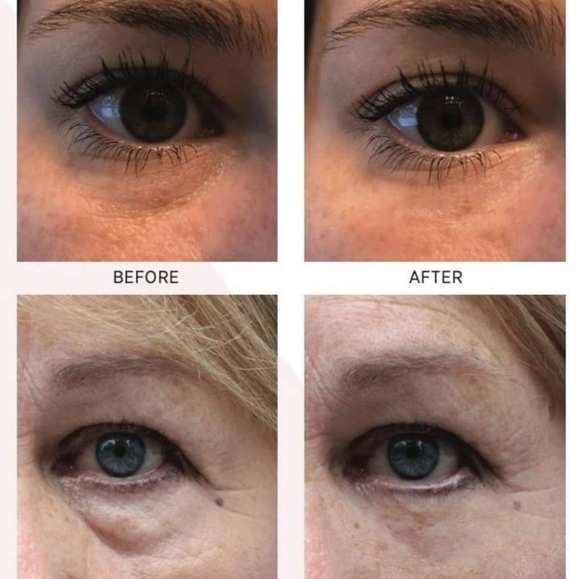 NEW! Rapid Rewind Wrinkle Reducer - Picture 7 of 16